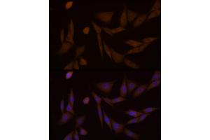 Immunofluorescence analysis of NIH/3T3 cells using PFKFB3 Rabbit mAb (ABIN1680620, ABIN3018306, ABIN3018307 and ABIN7101590) at dilution of 1:100 (40x lens). (PFKFB3 anticorps)