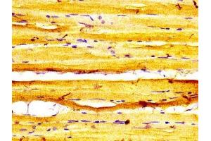 IHC image of ABIN7160609 diluted at 1:600 and staining in paraffin-embedded human skeletal muscle tissue performed on a Leica BondTM system. (MYBPC1 anticorps  (AA 618-779))