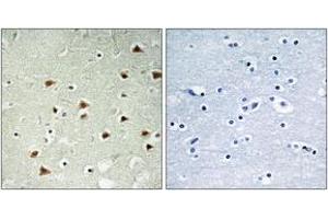 Immunohistochemistry (IHC) image for anti-Abhydrolase Domain Containing 14B (ABHD14B) (AA 161-210) antibody (ABIN2890083) (ABHD14B anticorps  (AA 161-210))