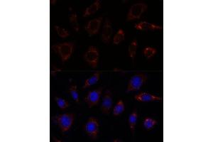 Immunofluorescence analysis of L929 cells using TBRG4 antibody  at dilution of 1:100.