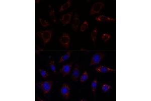 Immunofluorescence analysis of L929 cells using TBRG4 antibody  at dilution of 1:100. (TBRG4 anticorps  (AA 382-631))