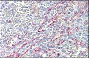 Human Spleen: Formalin-Fixed, Paraffin-Embedded (FFPE)