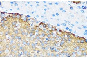 Immunohistochemistry of paraffin-embedded Mouse pancreatic islet using TSC1 Polyclonal Antibody at dilution of 1:200 (40x lens). (TSC1 anticorps)