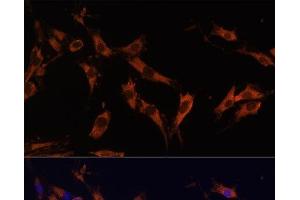 Immunofluorescence analysis of C6 cells using KSR1 Polyclonal Antibody at dilution of 1:100 (40x lens). (KSR1 anticorps)