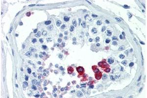 Human Testis (formalin-fixed, paraffin-embedded) stained with CCND1 antibody ABIN462139 followed by biotinylated goat anti-rabbit IgG secondary antibody ABIN481713, alkaline phosphatase-streptavidin and chromogen.