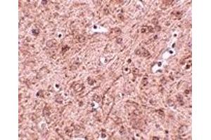 Immunohistochemistry (IHC) image for anti-Ceramide Synthase 6 (CERS6) (N-Term) antibody (ABIN1031437)