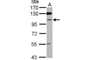 Western Blotting (WB) image for anti-Zinc Finger Protein 512B (ZNF512B) (Internal Region) antibody (ABIN1493532) (ZNF512B anticorps  (Internal Region))