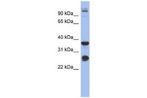 BGN antibody used at 1 ug/ml to detect target protein. (Biglycan anticorps  (Middle Region))