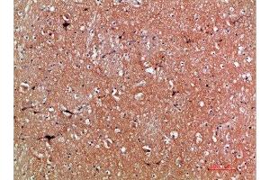 Immunohistochemical analysis of paraffin-embedded human-brain, antibody was diluted at 1:200 (Tenascin R anticorps  (AA 1270-1350))