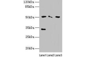 Western blot All lanes: SLC38A6 antibody at 12 μg/mL Lane 1: Mouse kidney tissue Lane 2: Mouse thymus tissue Lane 3: U87 whole cell lysate Secondary Goat polyclonal to rabbit IgG at 1/10000 dilution Predicted band size: 51, 58 kDa Observed band size: 51, 33 kDa