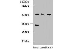 Western blot All lanes: SLC38A6 antibody at 12 μg/mL Lane 1: Mouse kidney tissue Lane 2: Mouse thymus tissue Lane 3: U87 whole cell lysate Secondary Goat polyclonal to rabbit IgG at 1/10000 dilution Predicted band size: 51, 58 kDa Observed band size: 51, 33 kDa (SLC38A6 anticorps  (AA 132-169))