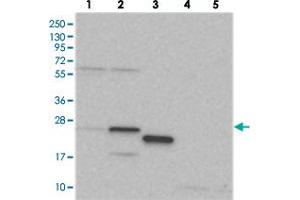 Western blot analysis of Lane 1: RT-4, Lane 2: U-251 MG, Lane 3: Human Plasma, Lane 4: Liver, Lane 5: Tonsil with RPL13A polyclonal antibody  at 1:250-1:500 dilution.