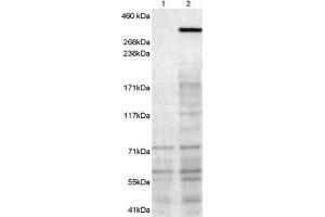 Western Blotting (WB) image for anti-Neurobeachin (NBEA) antibody (ABIN5872883) (Neurobeachin anticorps)