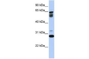 Western Blotting (WB) image for anti-Transmembrane Protein 187 (TMEM187) antibody (ABIN2458936) (TMEM187 anticorps)