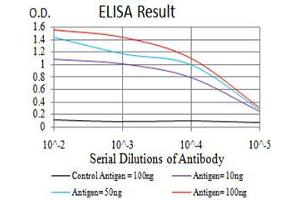 Black line: Control Antigen (100 ng),Purple line: Antigen (10 ng), Blue line: Antigen (50 ng), Red line:Antigen (100 ng)