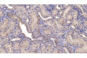 Detection of SFRP1 in Human Kidney Tissue using Monoclonal Antibody to Secreted Frizzled Related Protein 1 (SFRP1)
