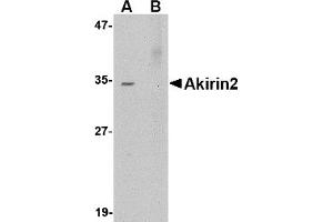 Western Blotting (WB) image for anti-Akirin 2 (AKIRIN2) (Middle Region 2) antibody (ABIN1031196) (AKIRIN2 anticorps  (Middle Region 2))