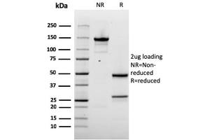 SDS-PAGE Analysis Purified Napsin A Mouse Monoclonal Antibody (rNAPSA/1239).