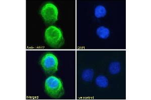 ABIN190867 Immunofluorescence analysis of paraformaldehyde fixed A431 cells, permeabilized with 0. (LARP1B anticorps  (Internal Region))
