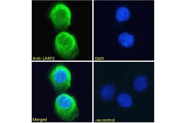 LARP1B anticorps  (Internal Region)