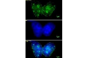 Histone H3 trimethyl Lys9 mAb (Clone 2AG-6F12-H4) tested by immunofluorescence. (Histone 3 anticorps  (H3K9me3))