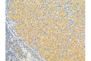 ABIN7093191 and ABIN7097196 at 1/100 staining Rat ovary tissue by IHC-P. (ERLIN2 anticorps  (C-Term))
