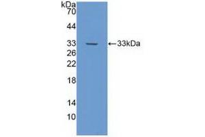 Detection of Recombinant NOTCH4, Human using Polyclonal Antibody to Notch Homolog 4 (NOTCH4)