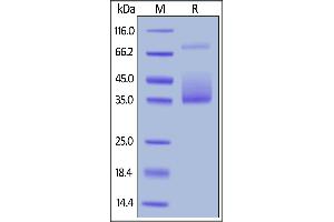 Biotinylated Human M-CSF, His,Avitag on  under reducing (R) condition. (M-CSF/CSF1 Protein (AA 33-255) (His tag,AVI tag,Biotin))