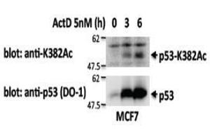 Western Blotting (WB) image for anti-Tumor Protein P53 (TP53) antibody (ABIN1449253) (p53 anticorps)