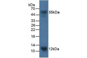 Detection of S100A14 in Porcine Stomach Tissue using Polyclonal Antibody to S100 Calcium Binding Protein A14 (S100A14) (S100A14 anticorps  (AA 1-91))
