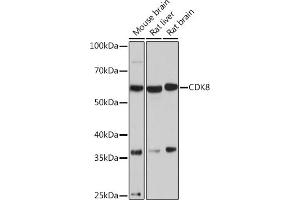 Western blot analysis of extracts of various cell lines, using CDK8 Rabbit mAb (ABIN7266596) at 1:1000 dilution. (CDK8 anticorps)