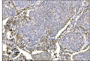 IHC analysis of MERTK using anti-MERTK antibody (ABIN7600623). (MERTK anticorps  (AA 21-489))