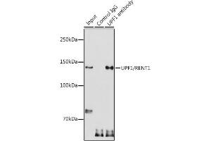 anti-UPF1 Regulator of Nonsense Transcripts Homolog (UPF1) (AA 270-370) antibody