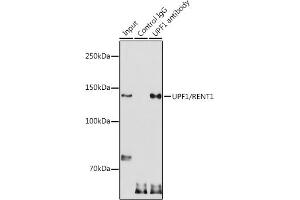 Immunoprecipitation analysis of 300 μg extracts of HeLa cells using 3 μg UPF1/RENT1 antibody (ABIN3022068, ABIN3022069, ABIN3022070 and ABIN6218593). (RENT1/UPF1 anticorps  (AA 270-370))