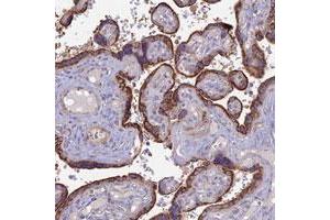 Immunohistochemical staining of human placenta with PTCD2 polyclonal antibody  shows strong cytoplasmic positivity in trophoblastic cells. (PTCD2 anticorps)