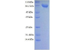 Protein expressed in E.