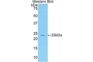 Western blot analysis of the recombinant protein. (Vitamin D-Binding Protein anticorps  (AA 18-211))
