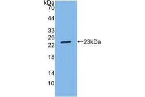 Figure. (SGPL1 anticorps  (AA 382-568))
