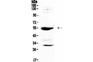 Western blot analysis of MMP13 using anti-MMP13 antibody .
