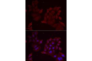 Immunofluorescence analysis of MCF7 cells using Pannexin 1 antibody (ABIN6128523, ABIN6145204, ABIN6145206 and ABIN6217644). (PANX1 anticorps  (AA 297-426))