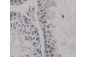 IHC-P analysis of Kidney tissue, with DAB staining. (NEK2 anticorps  (AA 125-393))