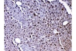 IHC testing of FFPE mouse liver tissue with Park7 antibody at 1ug/ml.