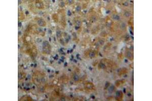 IHC-P analysis of Liver tissue, with DAB staining. (IL-17 anticorps  (AA 20-155))