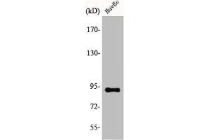 Western Blot analysis of COLO205 cells using AKAP 149 Polyclonal Antibody (AKAP1 anticorps  (Internal Region))