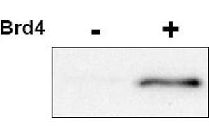 Image no. 1 for anti-Cyclin-Dependent Kinase 9 (CDK9) (pThr29) antibody (ABIN401390) (CDK9 anticorps  (pThr29))