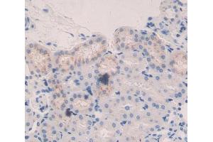 IHC-P analysis of kidney tissue, with DAB staining. (CTSA anticorps  (AA 215-470))