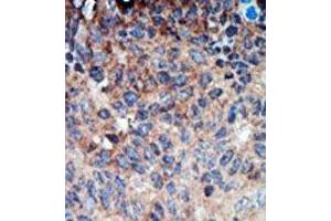 Image no. 2 for anti-Non-Metastatic Cells 1, Protein (NM23A) Expressed in (NME1) (N-Term) antibody (ABIN360544) (NME1 anticorps  (N-Term))
