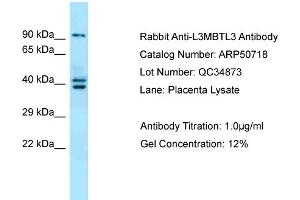WB Suggested Anti-L3MBTL3 Antibody Titration:  0. (L3MBTL3 anticorps  (N-Term))