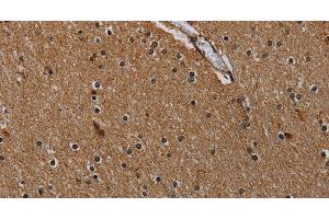 Immunohistochemistry of paraffin-embedded Human brain using IVL Polyclonal Antibody at dilution of 1:50 (Involucrin anticorps)