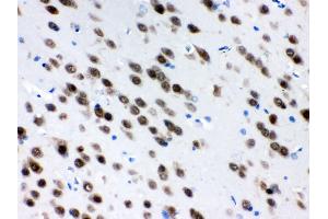 Anti- ELAVL4 Picoband antibody, IHC(P) IHC(P): Rat Brain Tissue (ELAVL4 anticorps  (N-Term))